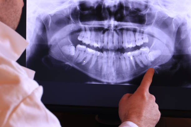 Best Emergency Dentist Near Me  in Colonial Pine Hills, SD