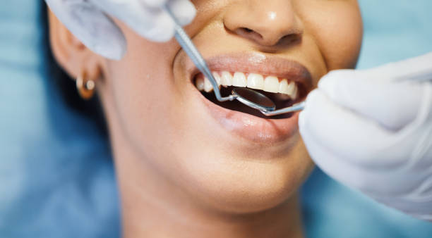 Best Urgent Tooth Repair  in Colonial Pine Hills, SD