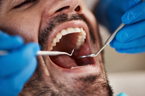 Best Urgent Dental Care  in Colonial Pine Hills, SD